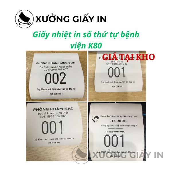 Giấy nhiệt in số thứ tự khám bệnh K80 - Giấy in phiếu khám, số chờ bệnh viện cao cấp